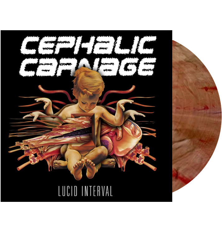 CEPHALIC CARNAGE - 'Lucid Interval' LP (Custom Marble)